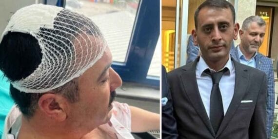 YRP'li İl Başkan Yardımcısı, Belediye Başkan Yardımcısı’nı şekerlikle yaraladı