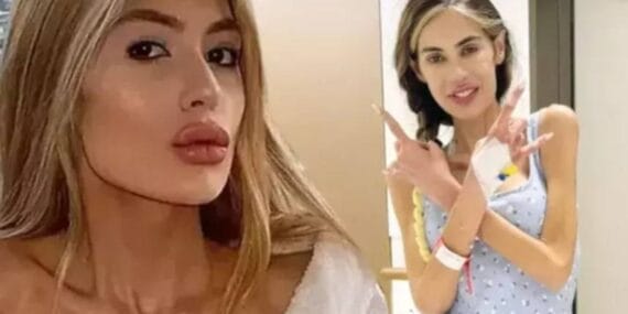 29 kiloya düştü yeniden yoğun bakıma kaldırıldı