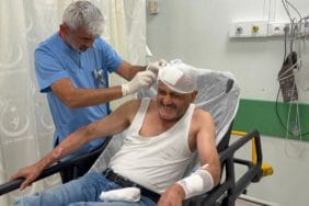 Piknik Kazası: Gaz Kaçağı Sonucu Alev Alan Adam Dereye Atlayarak Kurtuldu