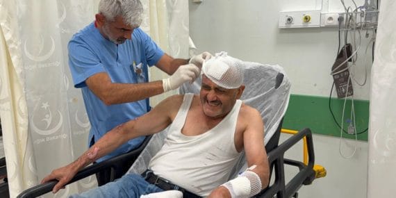 Piknik Kazası: Gaz Kaçağı Sonucu Alev Alan Adam Dereye Atlayarak Kurtuldu