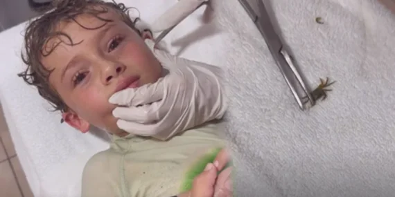 Çocuğun Kulağından Canlı Yengeç Çıkarıldı: Şaşırtıcı Olay Sosyal Medyada Gündem Oldu