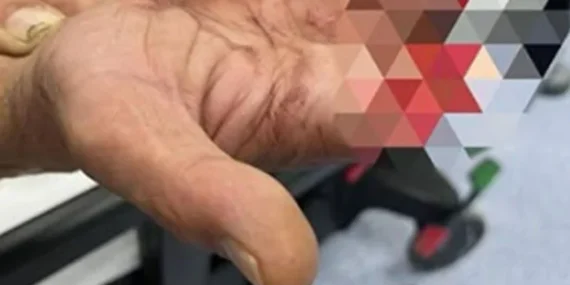 Isparta Organize Sanayi'de Korkutan Anlar: Halatın Kopmasıyla İşçi Tankerin Altında Kaldı