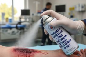 Kanamayi-Saniyeler-Icinde-Durduran-Devrim-Niteliginde-Sprey-gemini