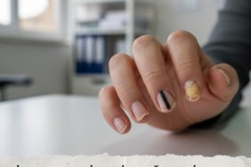 Tirnak-Rengi-Deyip-Gecmeyin-Ciddi-Hastaliklarin-Habercisi-Olabilir-gemini